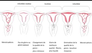 Glaire cervicale et grossesse