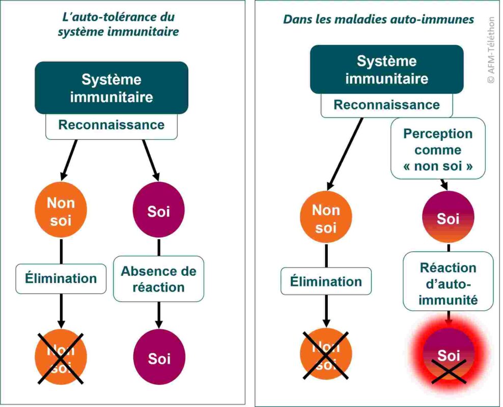 Comprendre Les Maladies Auto-Immunes